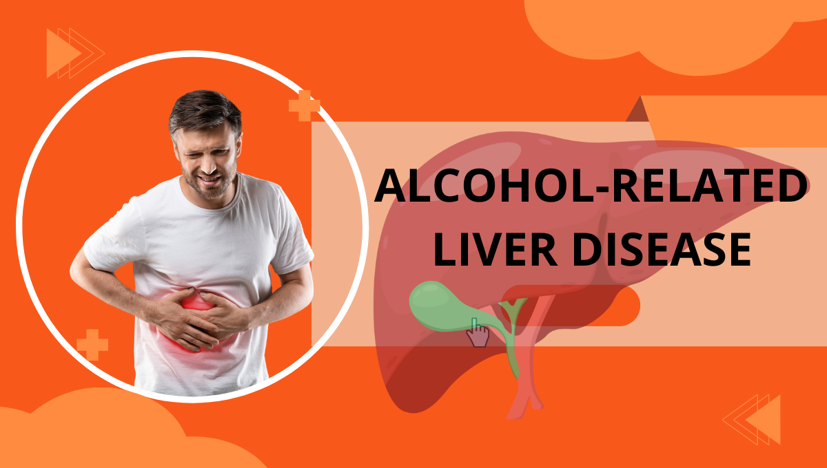 ALCOHOL-RELATED-LIVER-DISEASE