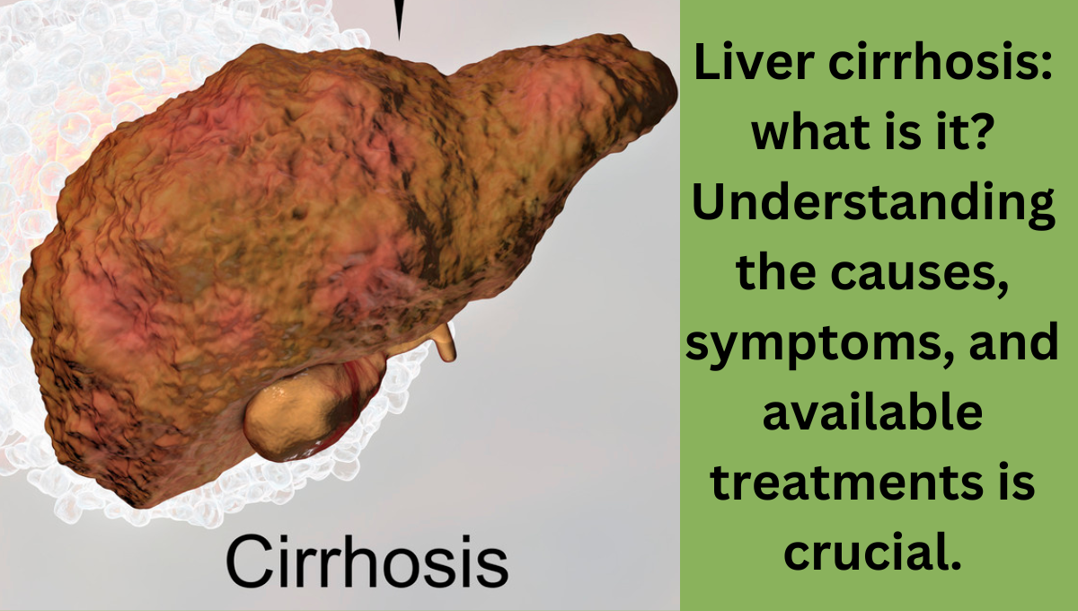Liver-cirrhosis-what-is-it-Understanding-the-causes-symptoms-and-available-treatments-is-crucial