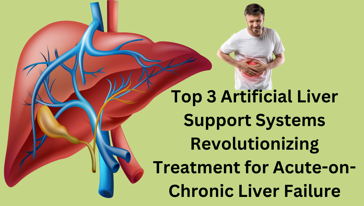 Top-3-Artificial-Liver-Support-Systems-Revolutionizing-Treatment-for-Acute-on-Chronic-Liver-Failure