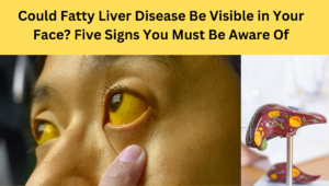 Could-Fatty-Liver-Disease-Be-Visible-in-Your-Face-Five-Signs-You-Must-Be-Aware-Of