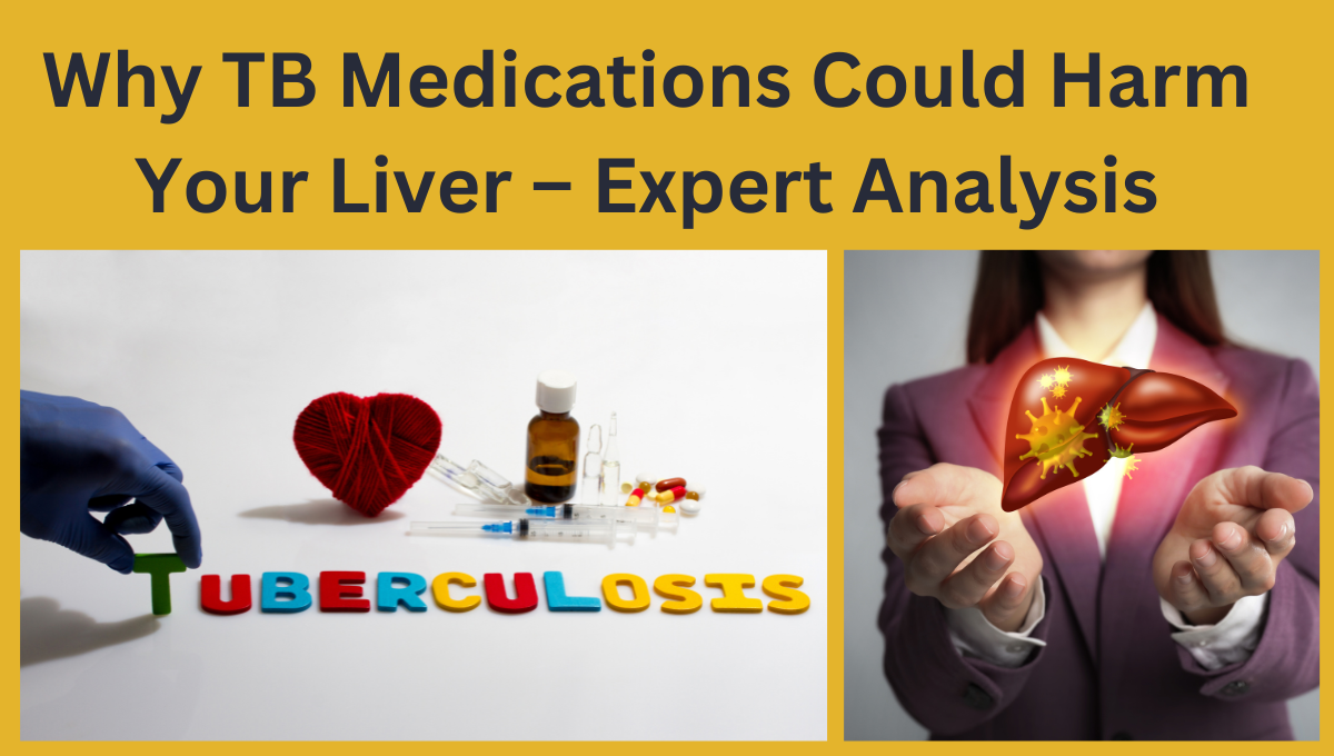 Why-Antituberculosis-Medication-May-Hurt-the-Liver