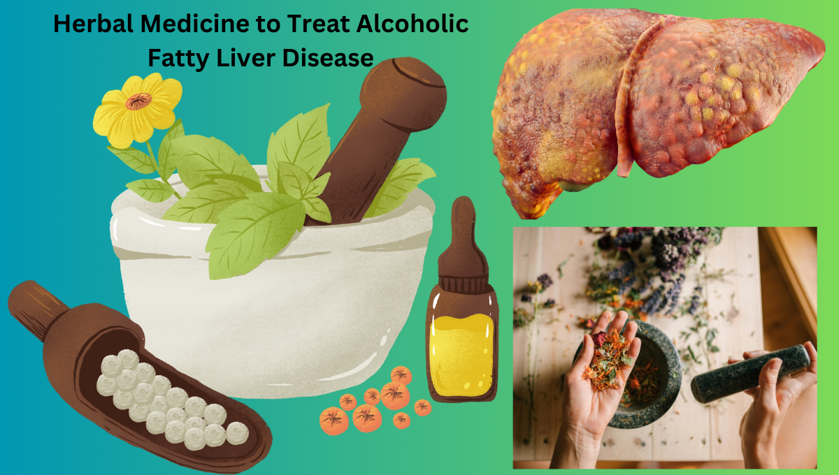 Herbal Medicine to Treat Alcoholic Fatty Liver Disease