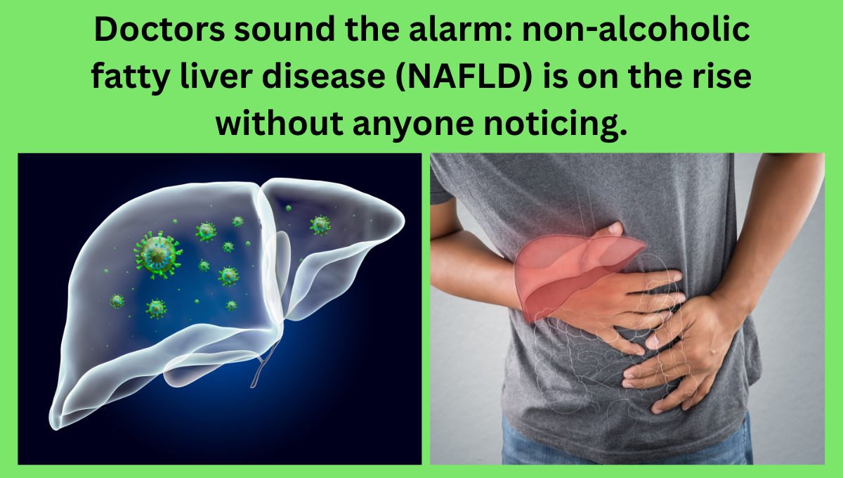 Doctors-sound-the-alarm-non-alcoholic-fatty-liver-disease-NAFLD-is-on-the-rise-without-anyone-noticing.