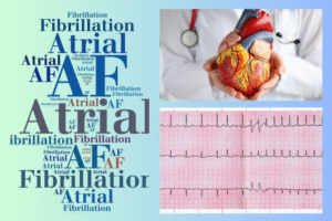atrial-fibrilation